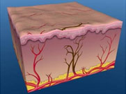 增加穿透深度減少副作用