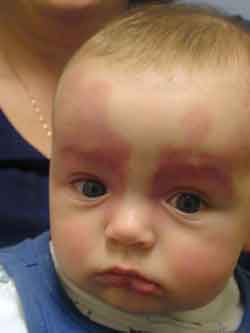 男科|男科圖片|男科癥狀|男科危害|男科治療|流產保胎狀男科|先兆流產狀男科|產后漏尿|藥物流產|外陰白斑|習慣性流產|混合型男科|包皮常識|宮頸糜爛|嬰幼兒男科|嬰兒男科|小兒男科|宮頸息肉|宮頸囊腫|無痛包皮|宮頸肥大|宮外孕