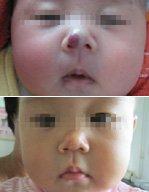 男科|男科圖片|男科癥狀|男科危害|男科治療|流產(chǎn)保胎狀男科|先兆流產(chǎn)狀男科|產(chǎn)后漏尿|藥物流產(chǎn)|外陰白斑|習(xí)慣性流產(chǎn)|混合型男科|包皮常識(shí)|宮頸糜爛|嬰幼兒男科|嬰兒男科|小兒男科|宮頸息肉|宮頸囊腫|無(wú)痛包皮|宮頸肥大|宮外孕