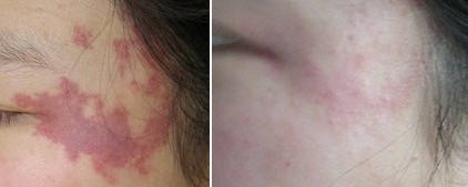 臉上男科嚴重嗎/男科嚴重嗎/男科圖片