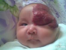 動(dòng)靜脈男科圖片